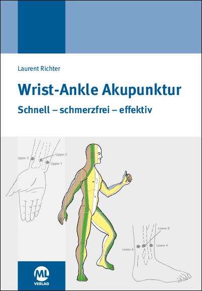 Wrist-Ankle-Akupunktur