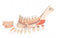 Unterkieferhälfte mit 8 kariösen Zähnen, 19-teilig